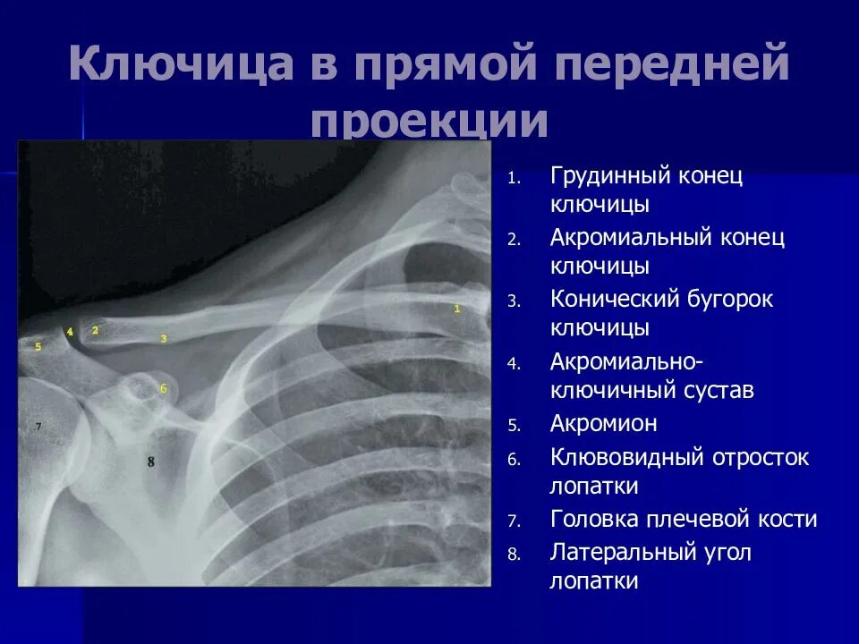 Ключица плечевого сустава. Ключица плечевого сустава
