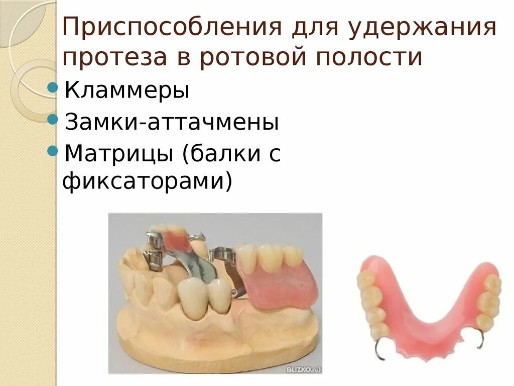 Клинико лабораторные этапы бюгельного протеза. Съемный пластиночный протез этапы. Бюгельный протез клинико-лабораторные этапы. Лабораторные этапы изготовления съемных пластиночных протезов.