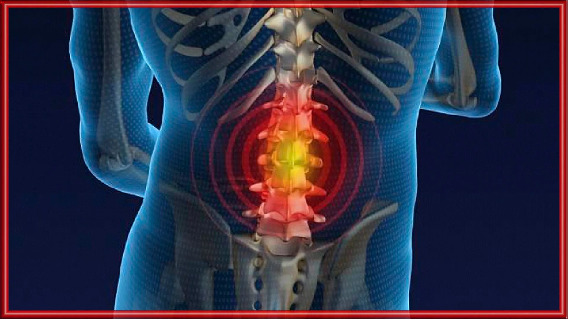 Болит нижний позвоночник. Боль в пояснице. Болит спина. Болит позвоночник. Защемление в крестцовом отделе позвоночника.