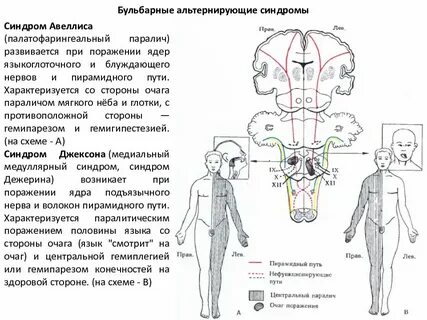Альтернирующие вебера