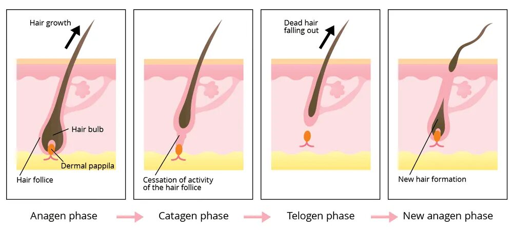 Первая фаза: анаген. Фазы роста волос анаген. Анаген катаген телоген. Телоген электроэпиляция. Можно ли удалять волосы лазером