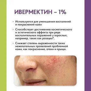 Розацеа препараты для лечения отзывы