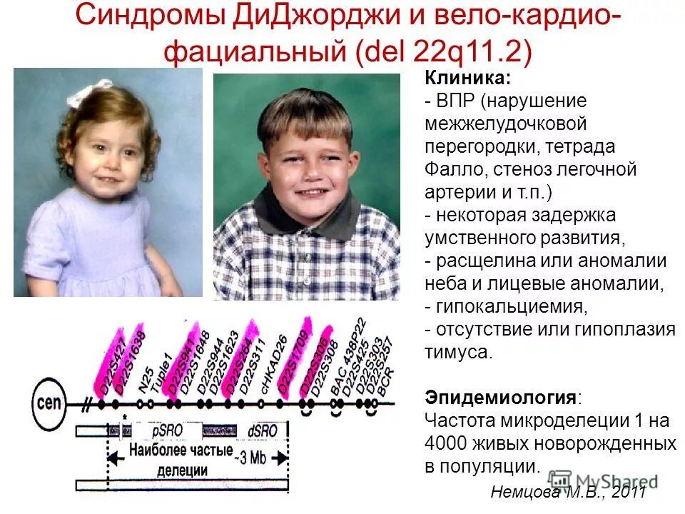 Микроделеция