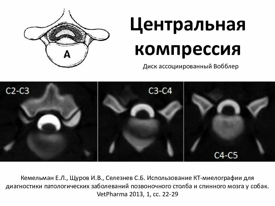 Центр сжатия. Центр сжатия