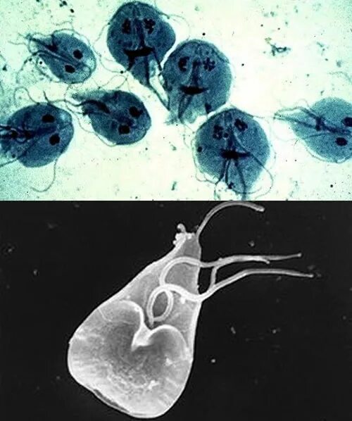 жгутиконосец лямблия. 21 век лямблии. лямблия классификация. лямблия (lamblia intestinalis). циста лямблии рисунок.
