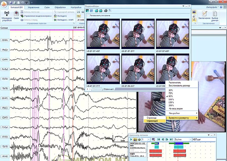 Ээг иваново. 6 Часовой ЭЭГ мониторинг. ЭЭГ-видеомониторинга. ЭЭГ видеомониторинг. ЭЭГ программы для.