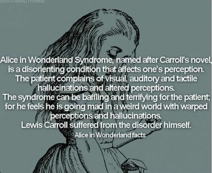 Is named after him. Alice in Wonderland Syndrome. Синдром Алисы в стране чудес. Льюис Кэрролл синдром Алисы. Alice in Wonderland Syndrome (AIWS).