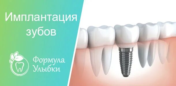 Вставить зубы недорого тюмень