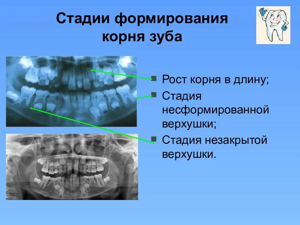 Этапы формирования зуба. Стадии формирования постоянного зуба.