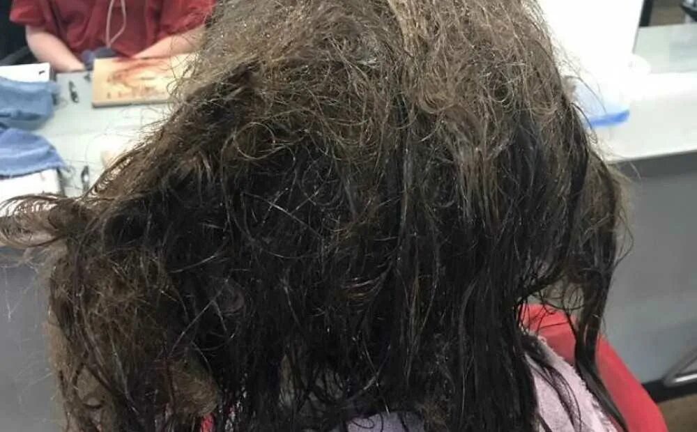 Очень сильно запутались волосы. Запутанные волосы колтуны. Очень сильно запутались волосы. Сильно запутанные волосы. Спутанные волосы.