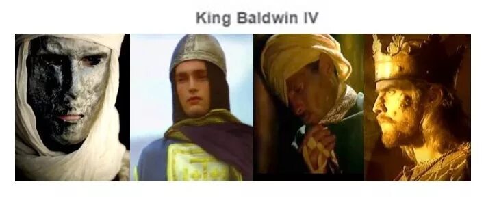 Умер ли король. Прокаженный Король Иерусалима без маски. Король Иерусалима Балдуин 4 без маски.