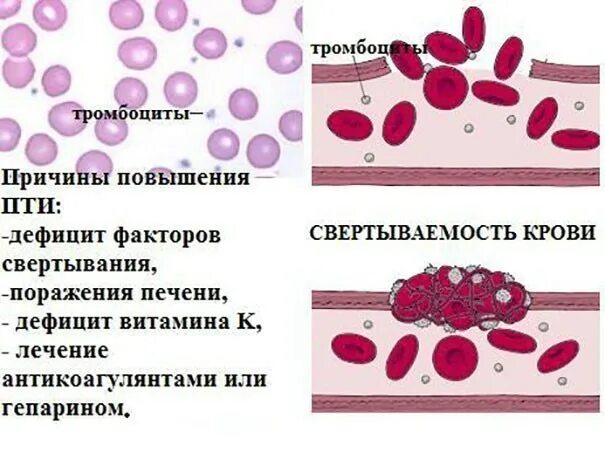 Почему кровь сворачивается при анализе. Причины повышения свертывания крови. Протромбиновый индекс повышение причины. Факторы вызывающие усиление свёртывания крови. Повышение свертываемости крови.