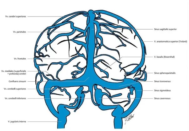 Верхние вены мозга. Венозная система головного мозга анатомия. Венозная система головного мозга схема. Вена Розенталя анатомия. Венозные синусы головного мозга анатомия.