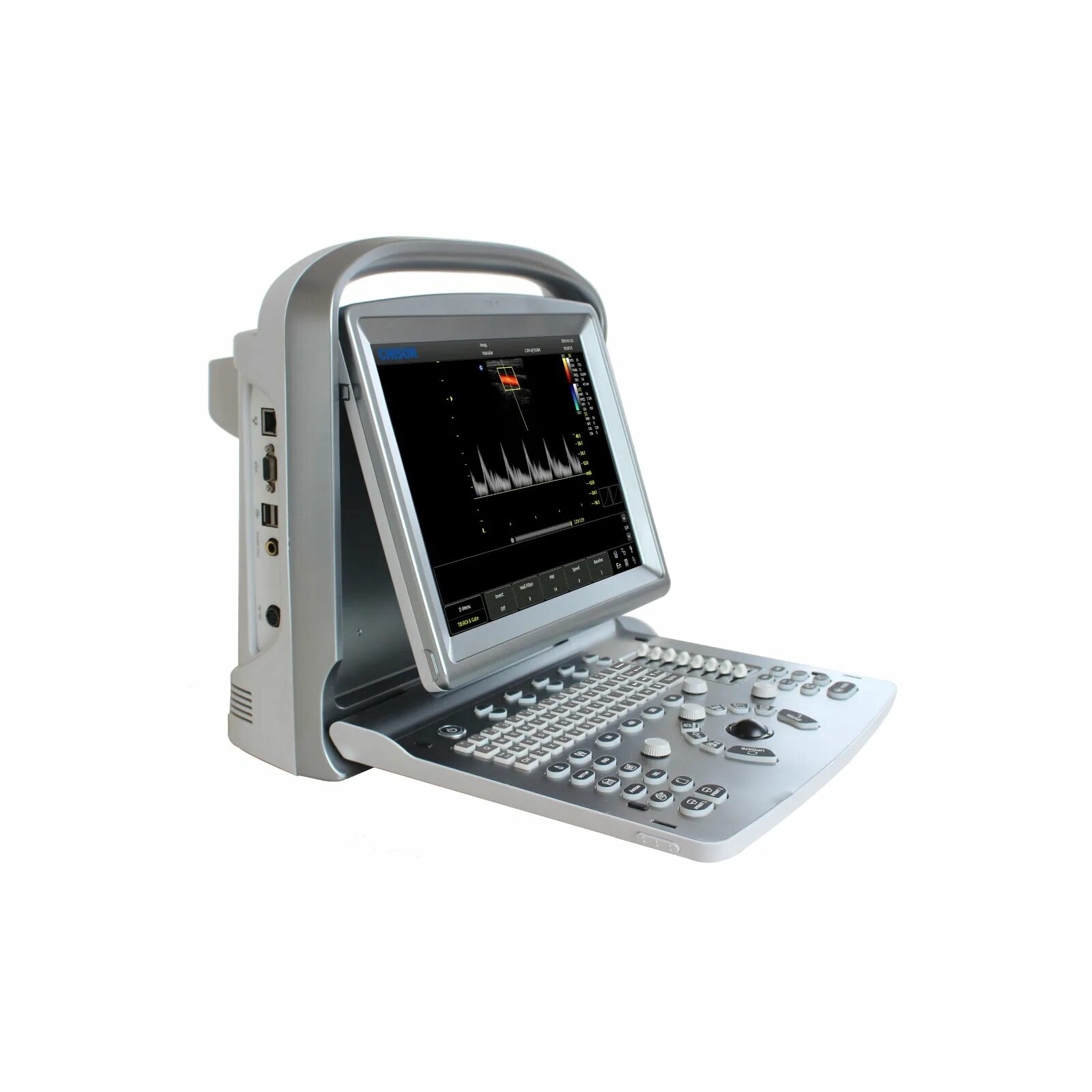 Chison sonotouch. Sonotouch 30. Chison sonotouch. Sonotouch 10. Chison sonotouch.