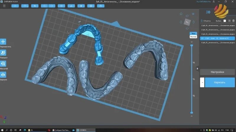 Chitubox 2.0. Читубокс. Фотополимерные модели челюстей.. Chitubox настройки для Anycubic Photon. Chitubox версии v1.7.0.