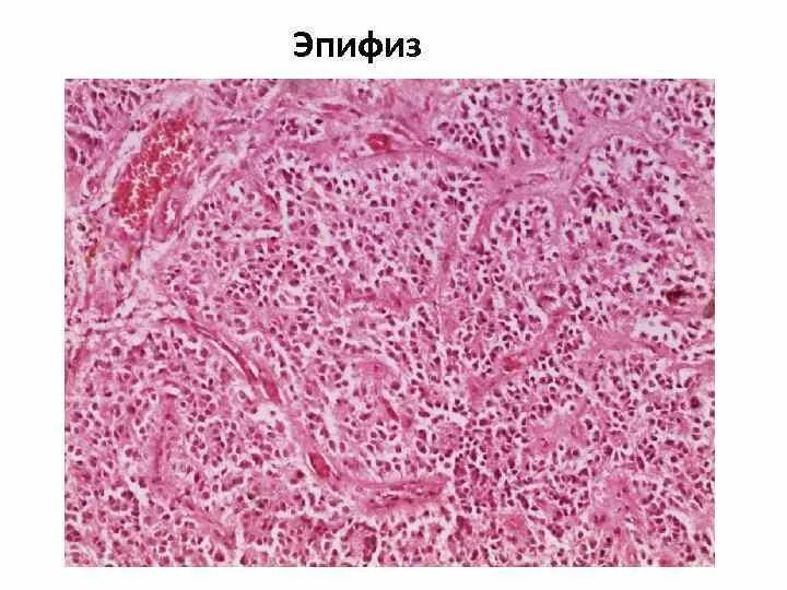 Микропрепарат головного мозга. Пинеалоциты эпифиза гистология. Эпифиз гистология препарат. Строение эпифиза гистология. Эпифиз препарат гистология с обозначениями.