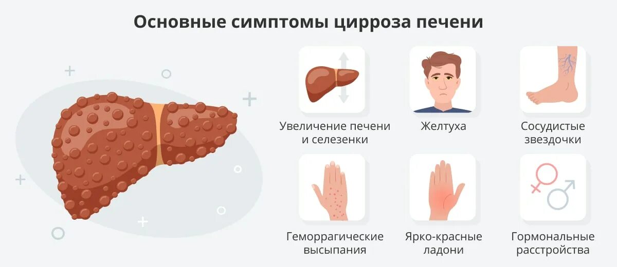 Печёночные ладони (пальмарная эритема). Ладони при циррозе печени. Кожные проявления цирроза печени. Цирроз печени проявления на коже. Увеличена печень причины и симптомы