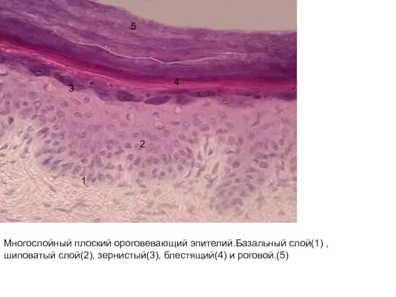 Слои переходного эпителия. Многослойный плоский ороговевающий эпителий. Многослойный плоский эпителий гистология. Многослойный плоский ороговевающий эпителий кожи. Многослойный плоский ороговевающий эпителий гистология препарат.