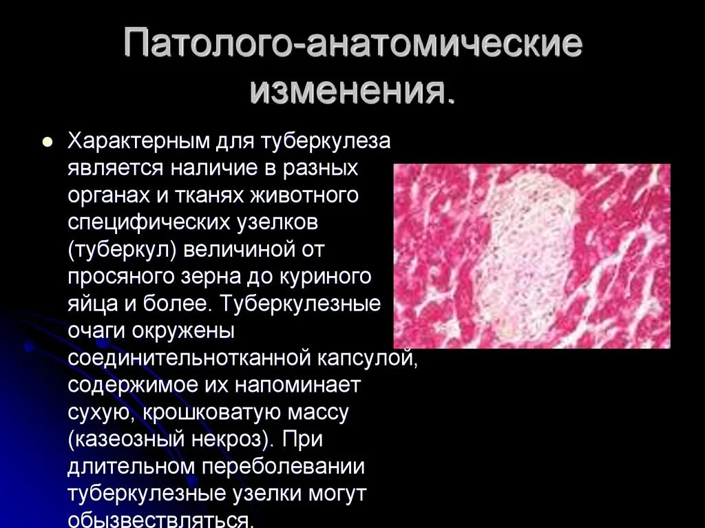 Для воспаления при туберкулезе характерно:. Поражение органов при туберкулезе. Для туберкулезного воспаления характерны. Очаг туберкулезного воспаления.