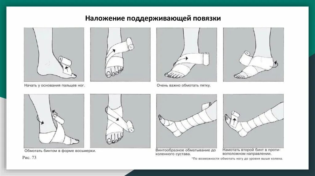 Эластичное бинтование конечности. Забинтовать голеностоп эластичным бинтом. Перебинтовать стопу эластичным бинтом. Перевязка стопы эластичным бинтом. Перевязка голеностопного сустава.