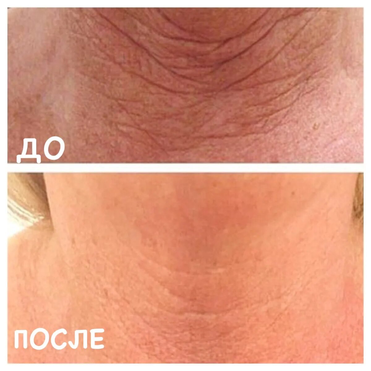Маска для лица Batel Mondsub с лимоном и коллагеном - "Я буду в жёлтом! Громкие 