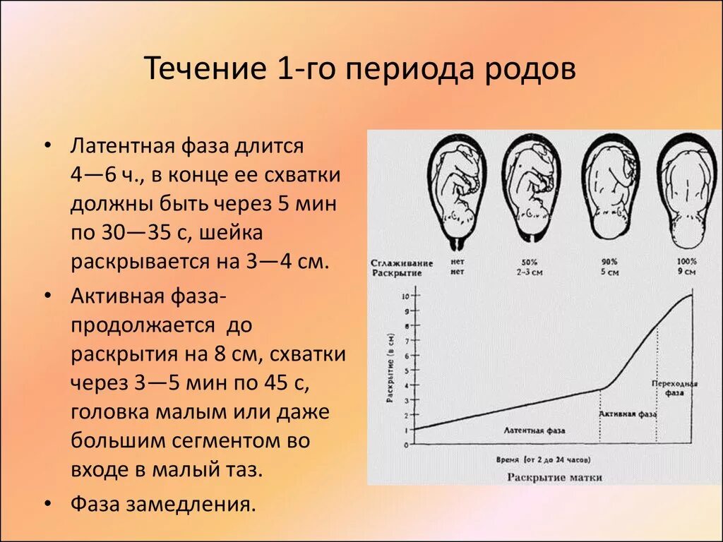 Оценка схваток. Фазы 3 периода родов. Фазы первого периода родов. Роды периоды родов их Продолжительность. Стадии первого периода родов.