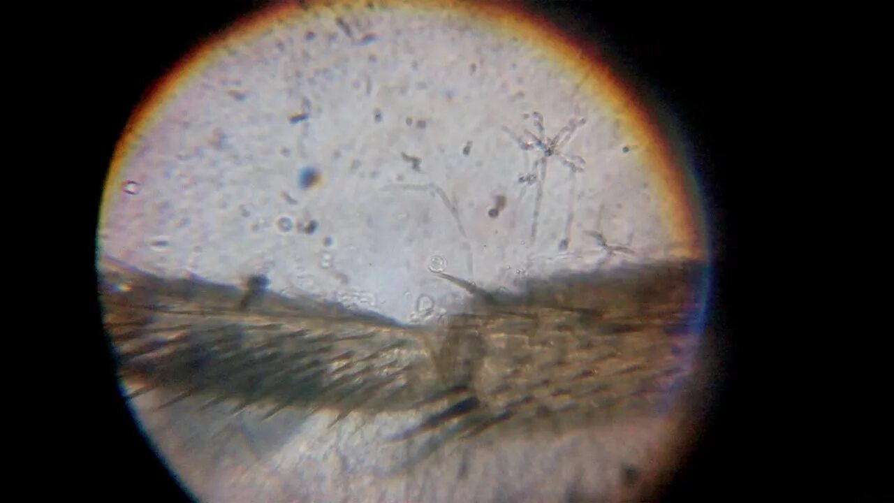 Мошка под микроскопом фото. Мошка гнус под микроскопом. Зубы мошки под микроскопом. Мошка под микроскопом челюсти. Зубы мошкары под микроскопом.