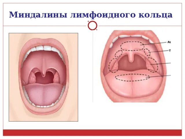 Выполняемые функции миндалины. Глоточная миндалина функции. лимфоидная ткань глоточного кольца. строение миндалин схема.
