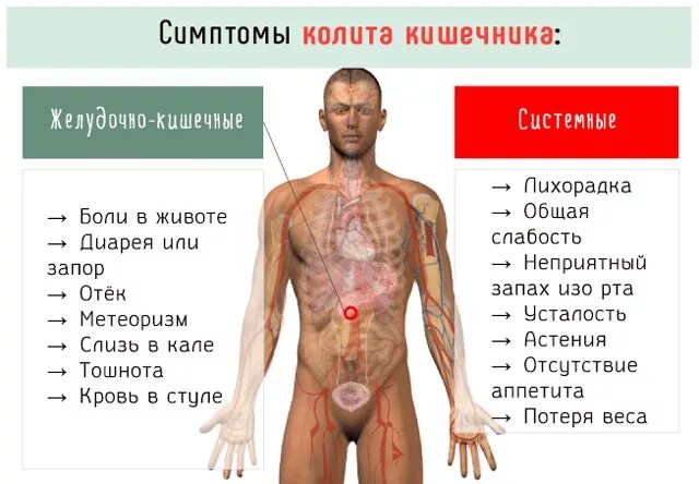 Колит симптомы у взрослых мужчин. Колит кишечника симптомы. Основные симптомы хронического колита. Калиты в кишечнике симптомы.