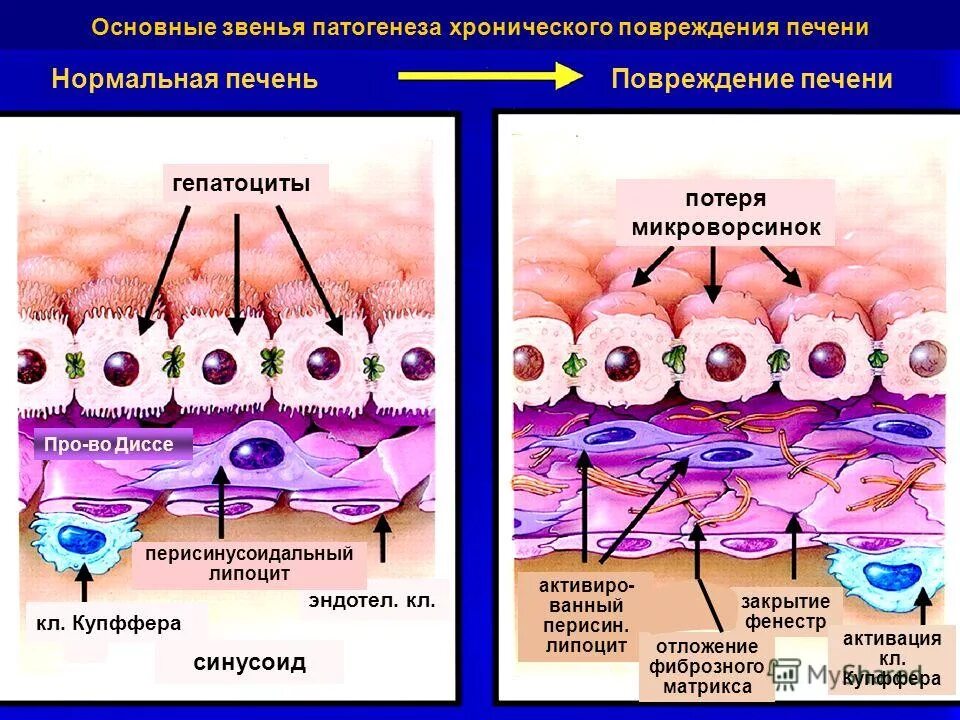 Липоциты