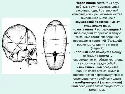 Швы головки