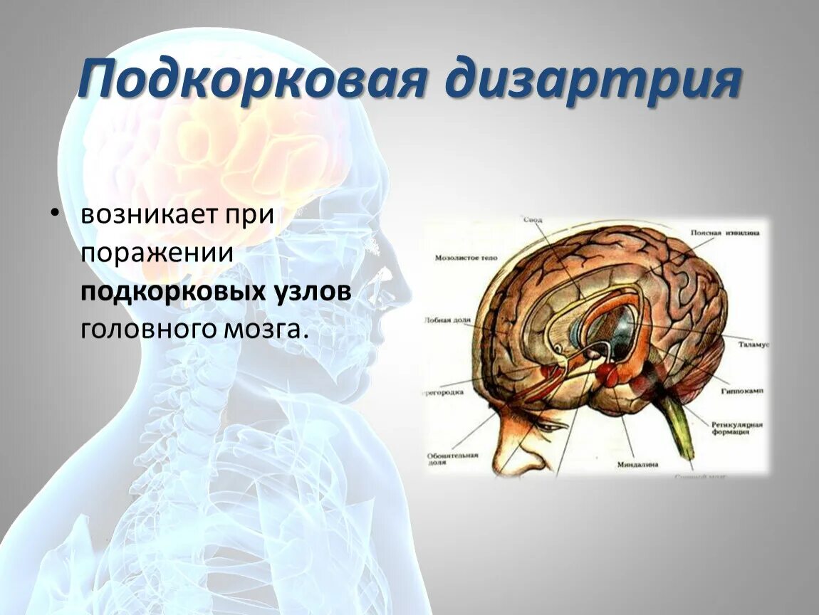 Подкорковые поражения мозга. Дизартрия очаг поражения. Локализация поражения при экстрапирамидной дизартрии. Подкорковая дизартрия локализация. Симптоматика подкорковой дизартрии.