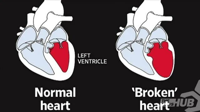 Can i broken. Broken heart подменю. died of a broken heart. heart and broken heart.