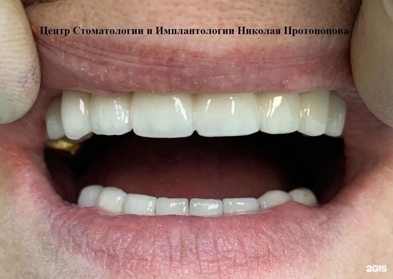 Центр стоматологии Николая Протопопова, проспект Ленина, 18Б, Петрозаводск - 2ГИ