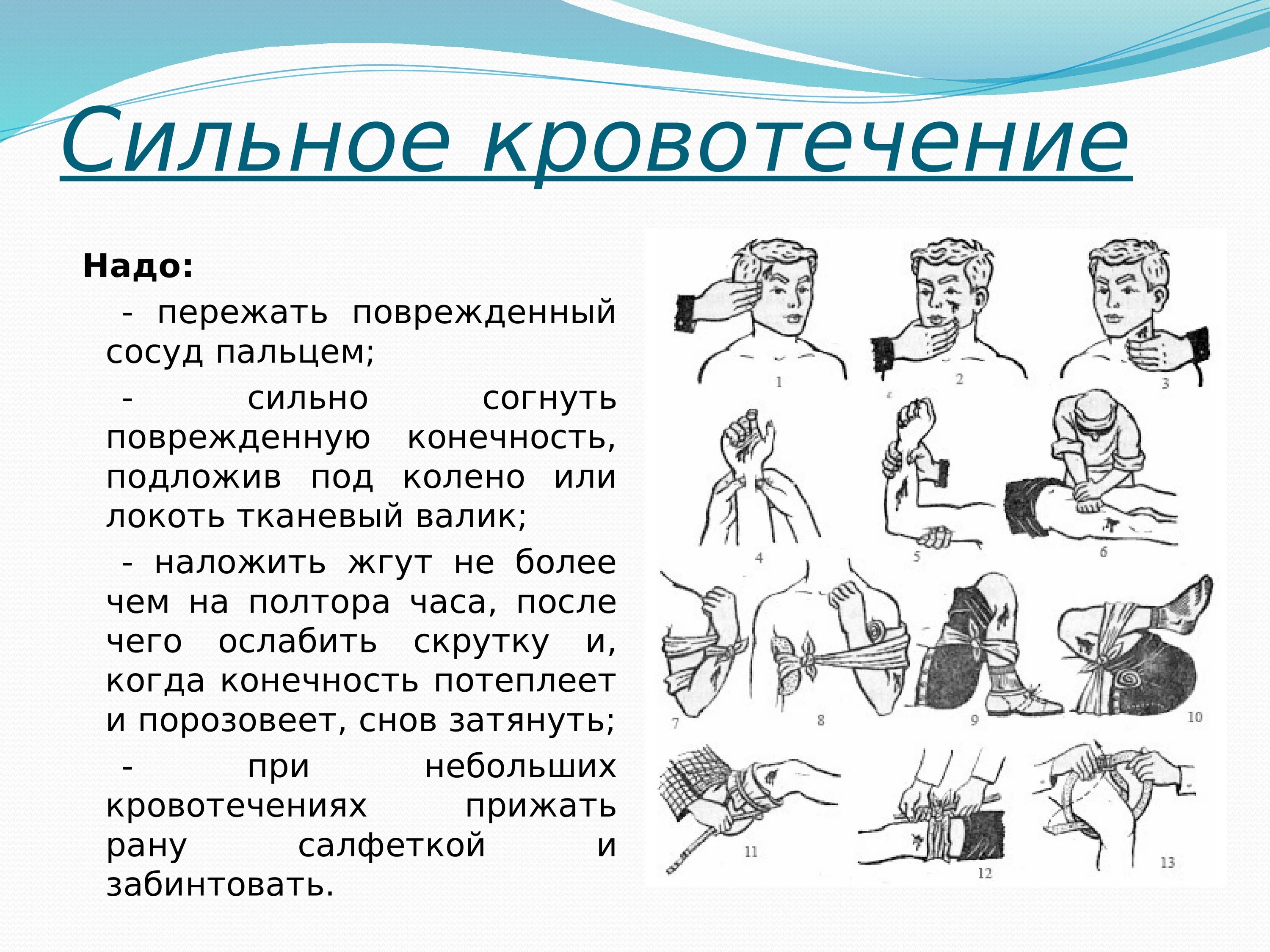 Причины сильного кровотечения. Кровотечения медицина катастроф лекция. При кровотечении надо поврежденный сосуд. Классификация кровотечений по виду поврежденного сосуда. Виды кровотечений в зависимости от повреждённого сосуда.