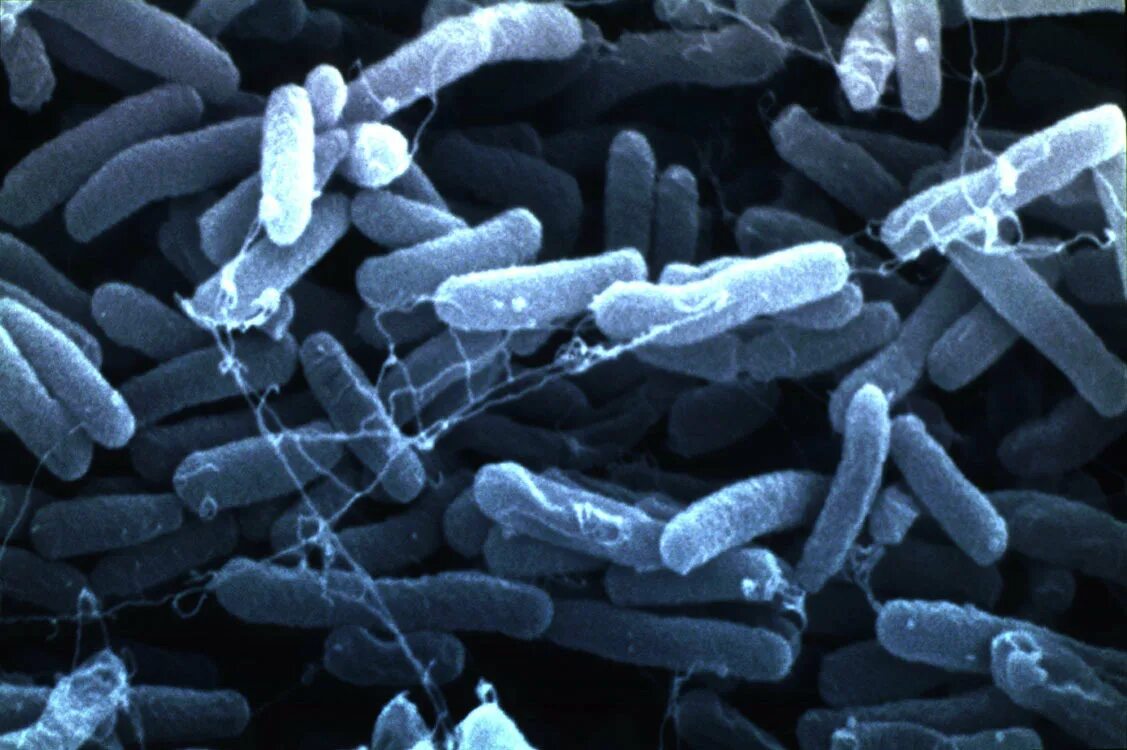 Микроорганизмы кишечная палочка. Бактерия Escherichia coli. Болезнетворные бактерии кишечная палочка. Бактериальные микробы кишечная палочка.