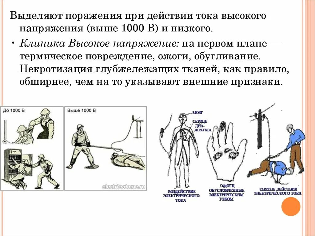 Поражение током симптомы. Оказание помощи при поражении электрическим током. Алгоритм оказания первой помощи при поражении молнией. Оказание первой помощи при утоплении электротравме. Оказание первой помощи при электротравмах.