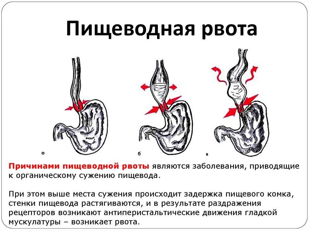 Тошнит второй