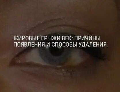 Верхнее веко грыжа
