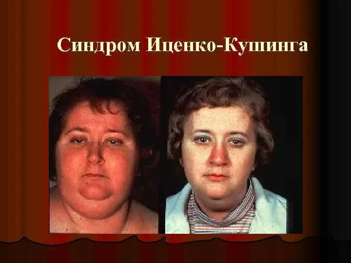 Узи почек, надпочечников и забрюшинного пространства в москве