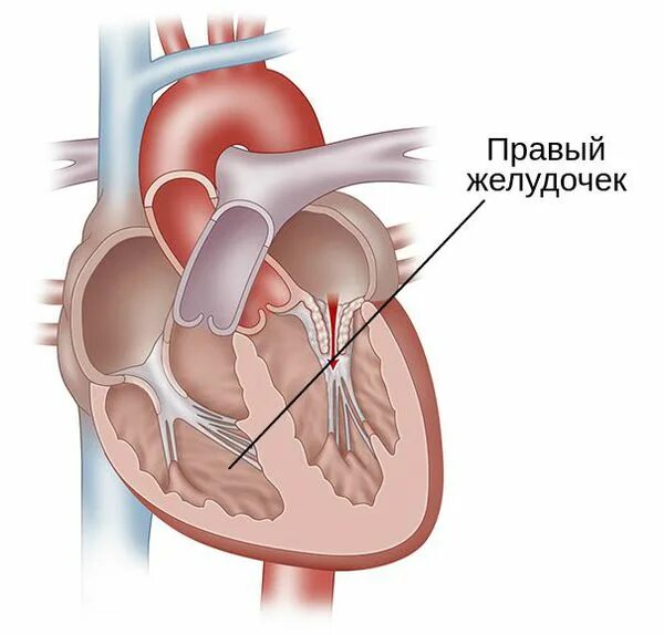 Стеноз митрального клапана. Правый желудочек сердца. Предсердия и желудочки сердца. Правое предсердие отделено от правого желудочка