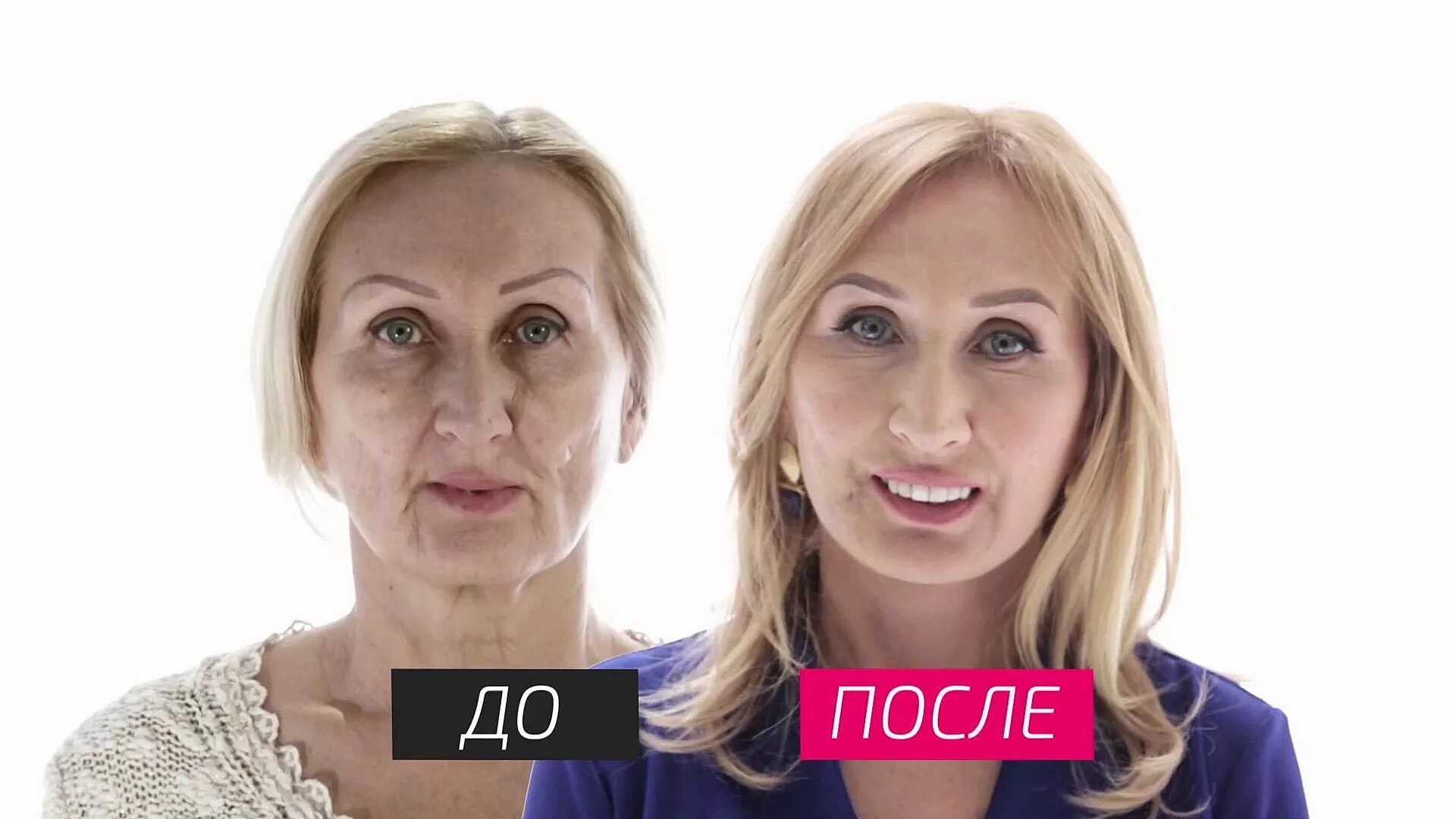 На несколько лет моложе. На 10 лет моложе эльза хрыкова. на десять лет моложе. шоу на 10 лет моложе. проект на 10 лет моложе.