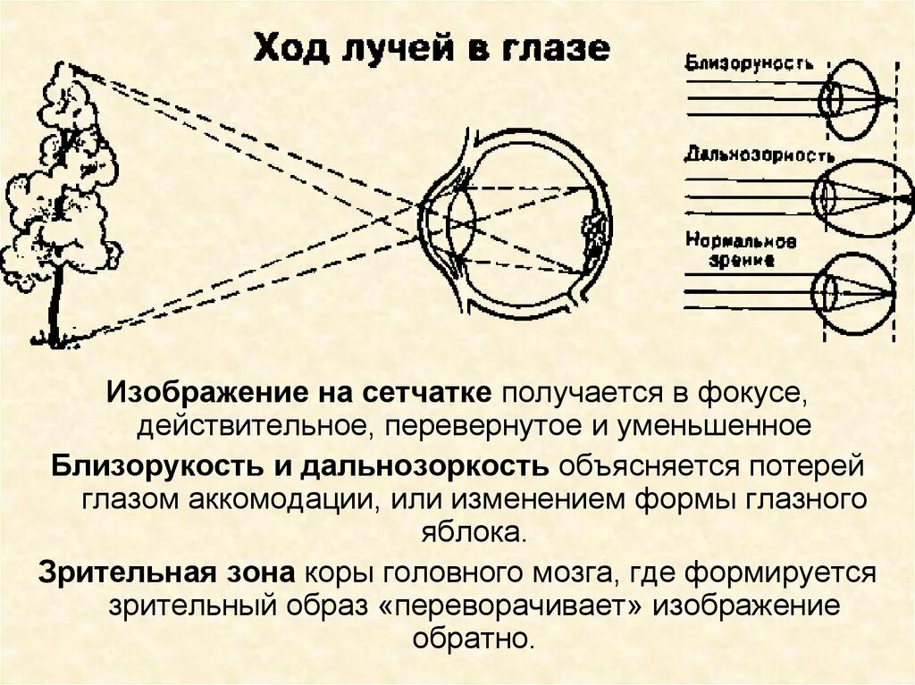 Изображение на сетчатке глаза появляется. Изображение на сетчатке. Изображение на сетчатке получается. Изображение на сетчатке глаза. Формирование изображения на сетчатке.