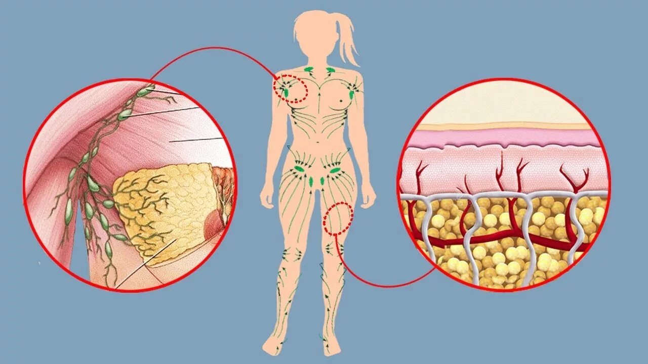 Лимфа включает. Лимфатическая система человека. Направление движения лимфы в организме человека картинка. Лимфатическая система массаж. Лимфатический массаж тела схема.