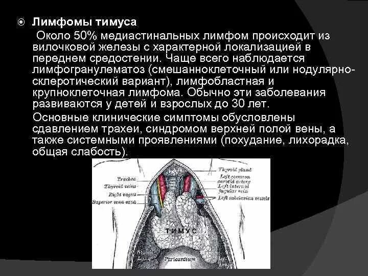 Медиастинальная в крупноклеточная лимфома. Лимфома Ходжкина средостения. Опухоли переднего средостения. Лимфогранулематоз средостения.