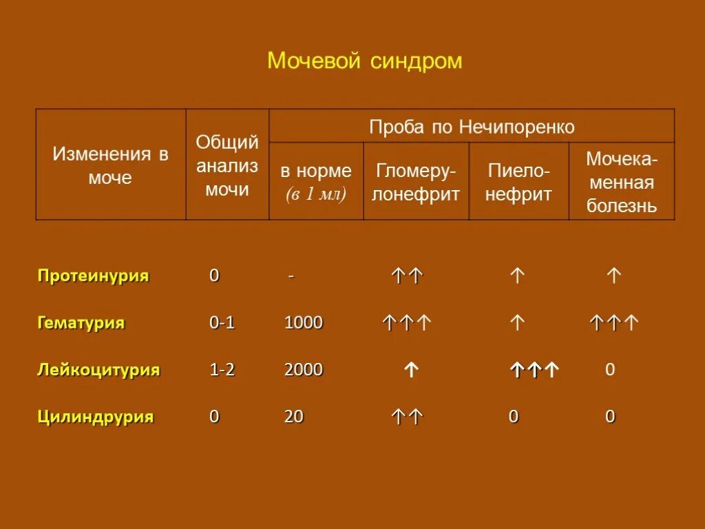 Нефротический синдром моча. Лабораторные показатели при мочевом синдроме. Нефротический синдром моча анализ. Мочевой синдром общий анализ мочи. Анализы при мочевом синдроме.