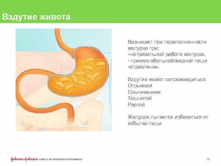 Бурление в животе после еды лечение. Вздутие живота желудка. Вздутие живота в области желудка. Вздутие живота после пищи.