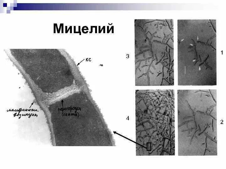 Обнаружен мицелий гриба что это значит. Псевдомицелий кандида. Септированный мицелий строение. Грибница мицелий. Дрожжеподобные грибы: псевдомицелий.
