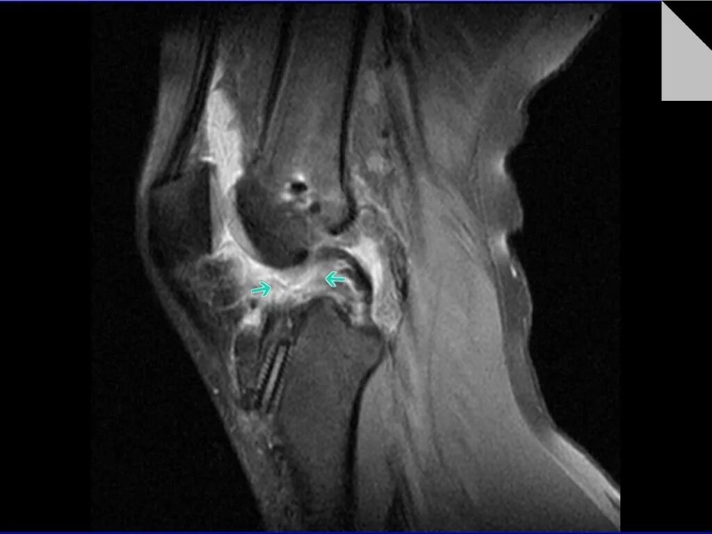 мрт суставов тела