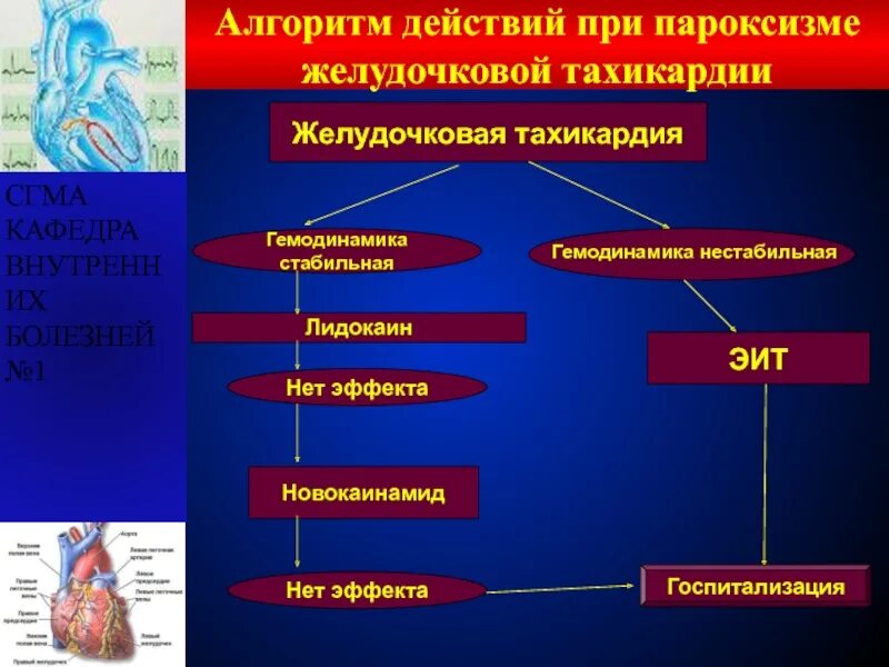 Нестабильная гемодинамика. Электроимпульсная терапия при пароксизме желудочковой тахикардии. Пароксизмальной тахикардии нестабильная гемодинамика. Алгоритм купирования желудочковой тахикардии. Алгоритм купирования пароксизма желудочковой тахикардии.